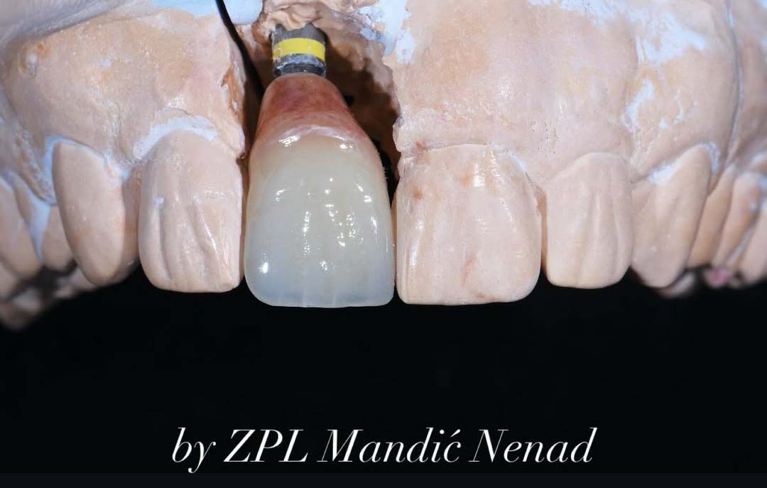 Zubno protetska laboratorija Mandić Nenad